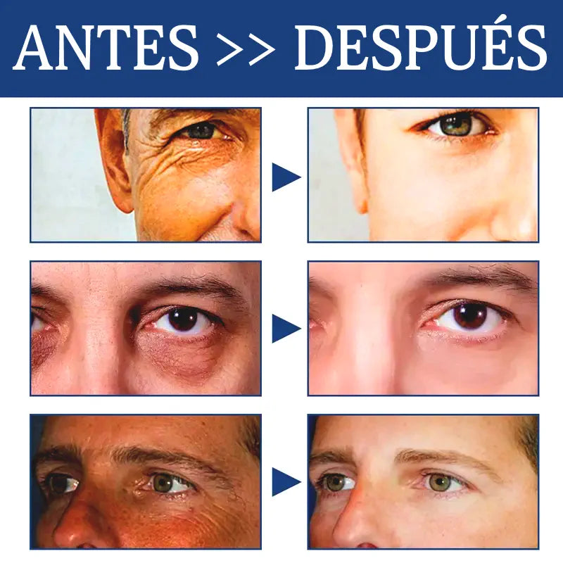 SERUM HIDRATANTE FACIAL CON ÁCIDO HIALURÓNICO PARA CABALLEROS LUNOON®